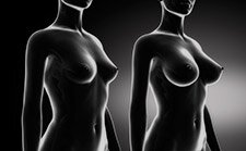 aumentar senos bustos mamas en guadalajara mexico
