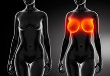 cirugia plastica senos aumento incremento mamas