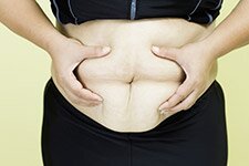 como quitar flacidez abdomen postparto despues hijos