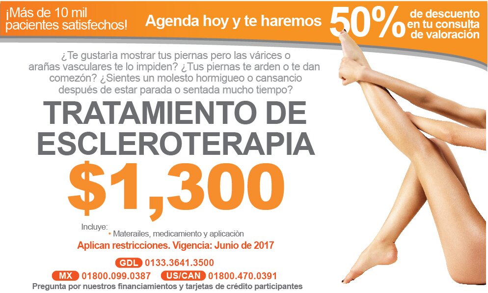 tratamiento de varices con escleroterapia