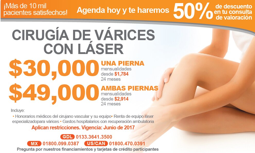 cirugia varices laser